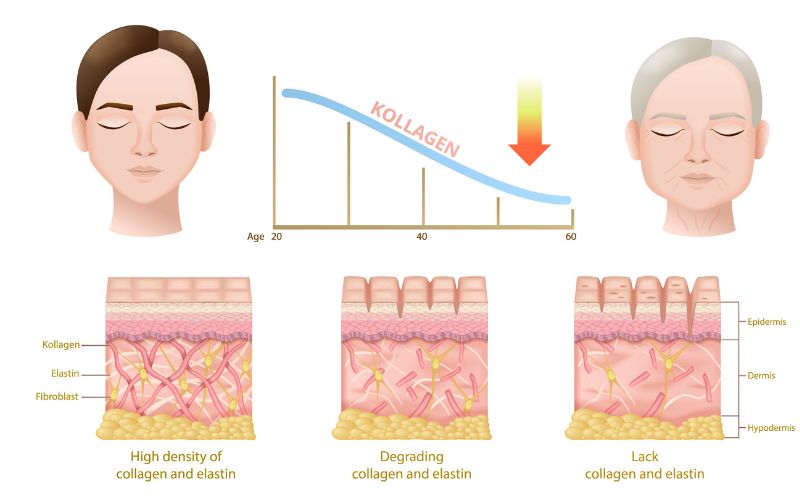 Từ 25 tuổi trở đi, làn da bắt đầu mất đi 1% lượng collagen mỗi năm, dẫn đến sự suy giảm độ đàn hồi
