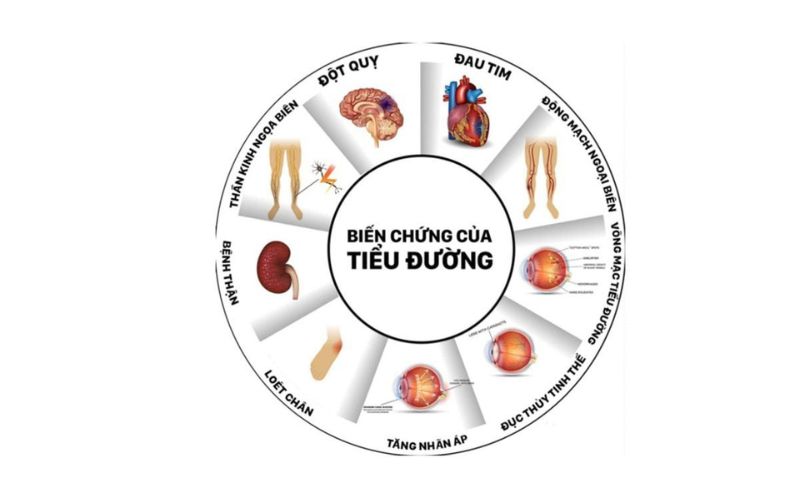 Biến chứng tiểu đường mãn tính là những vấn đề sức khỏe phát sinh trong thời gian dài 