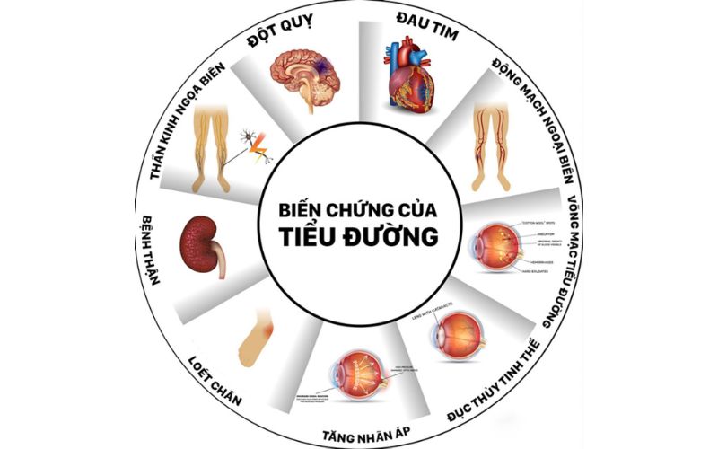 Tế bào gốc điều trị tiểu đường có thể giúp giảm nguy cơ biến chứng nghiêm trọng